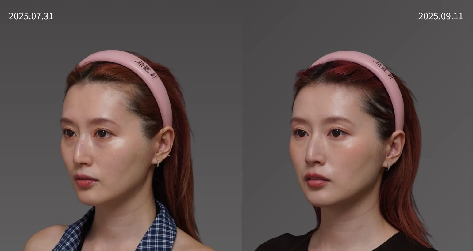 20250731朱綺綺   鳳凰電波 側面