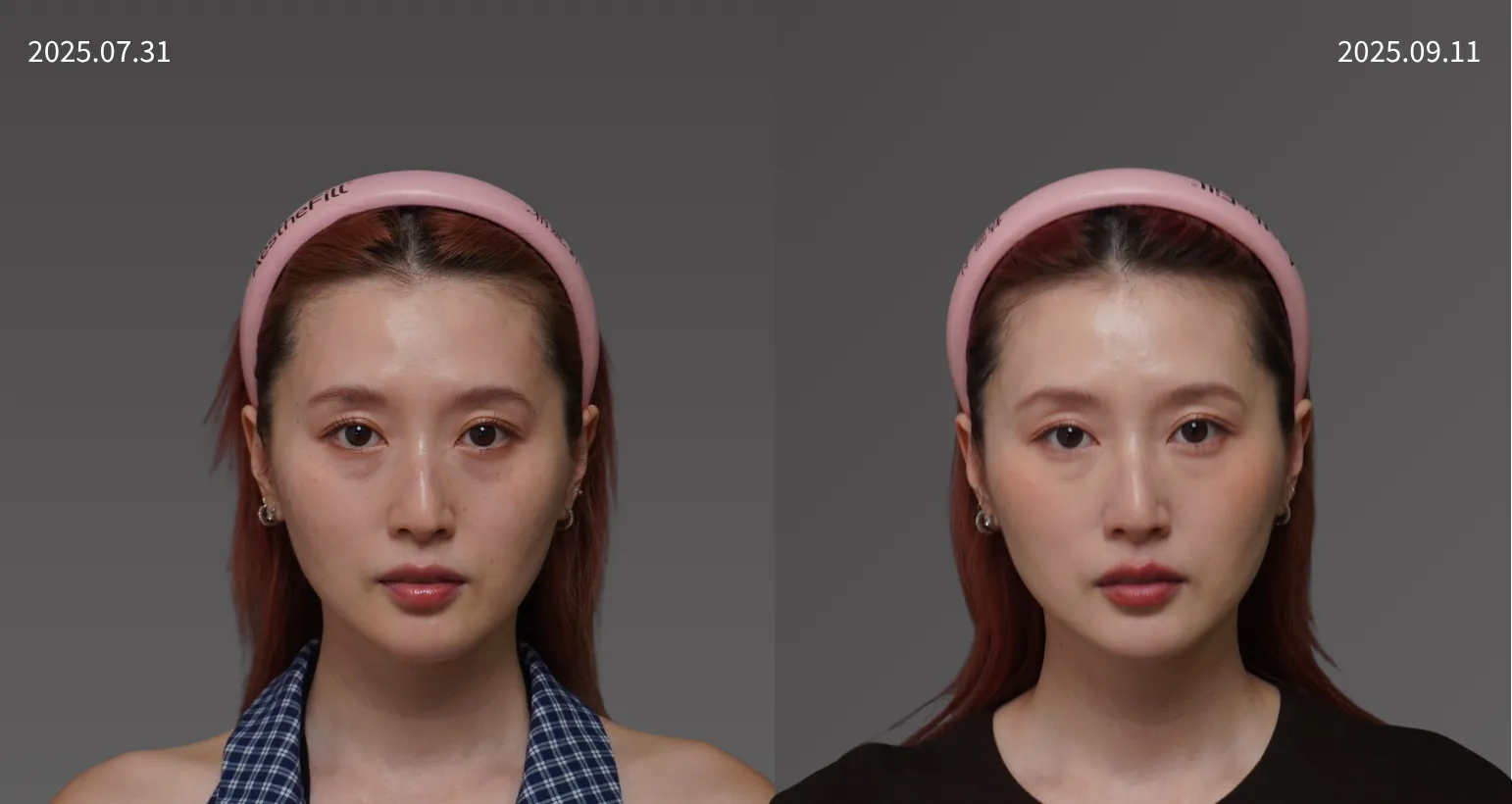 20250731朱綺綺   鳳凰電波 正面