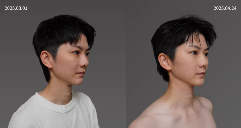 20250301Roy   縮胸、天鵝頸