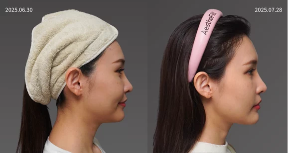 20250308黃巧梅 雙子音波 13 1