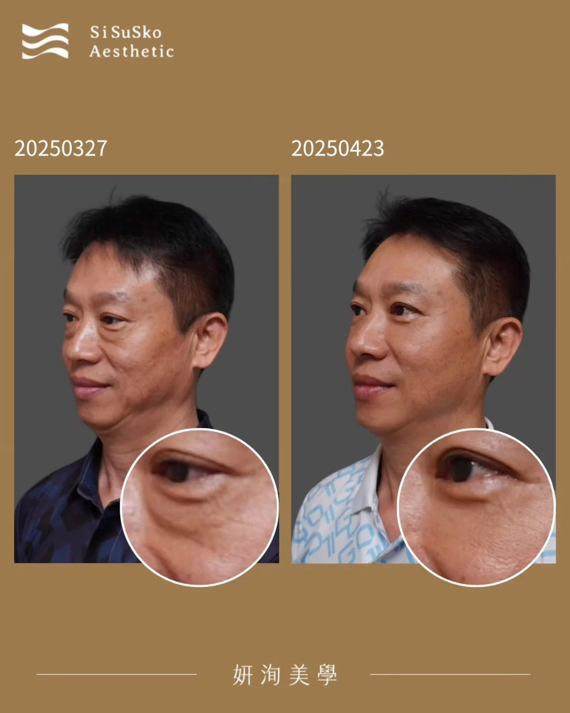 Sisusko 502114814 712202494723013 8343743449599374286 N