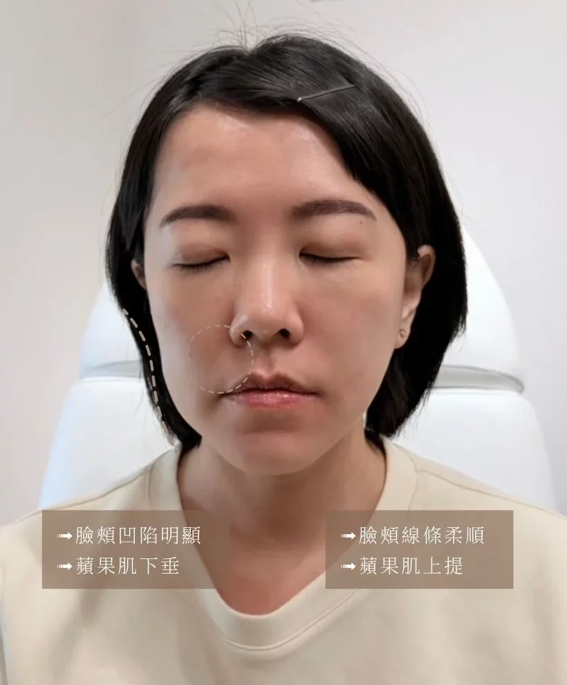 妍洵限動 2026 02 03T192038.102