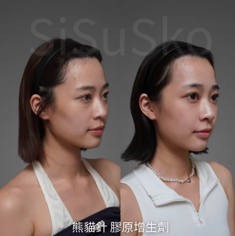 螢幕擷取畫面 2026 03 12 151837