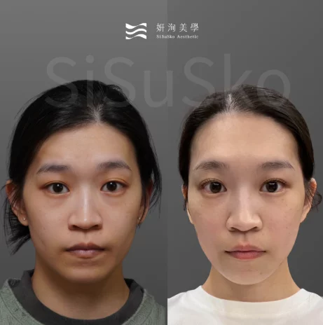 螢幕擷取畫面 2026 03 12 152651