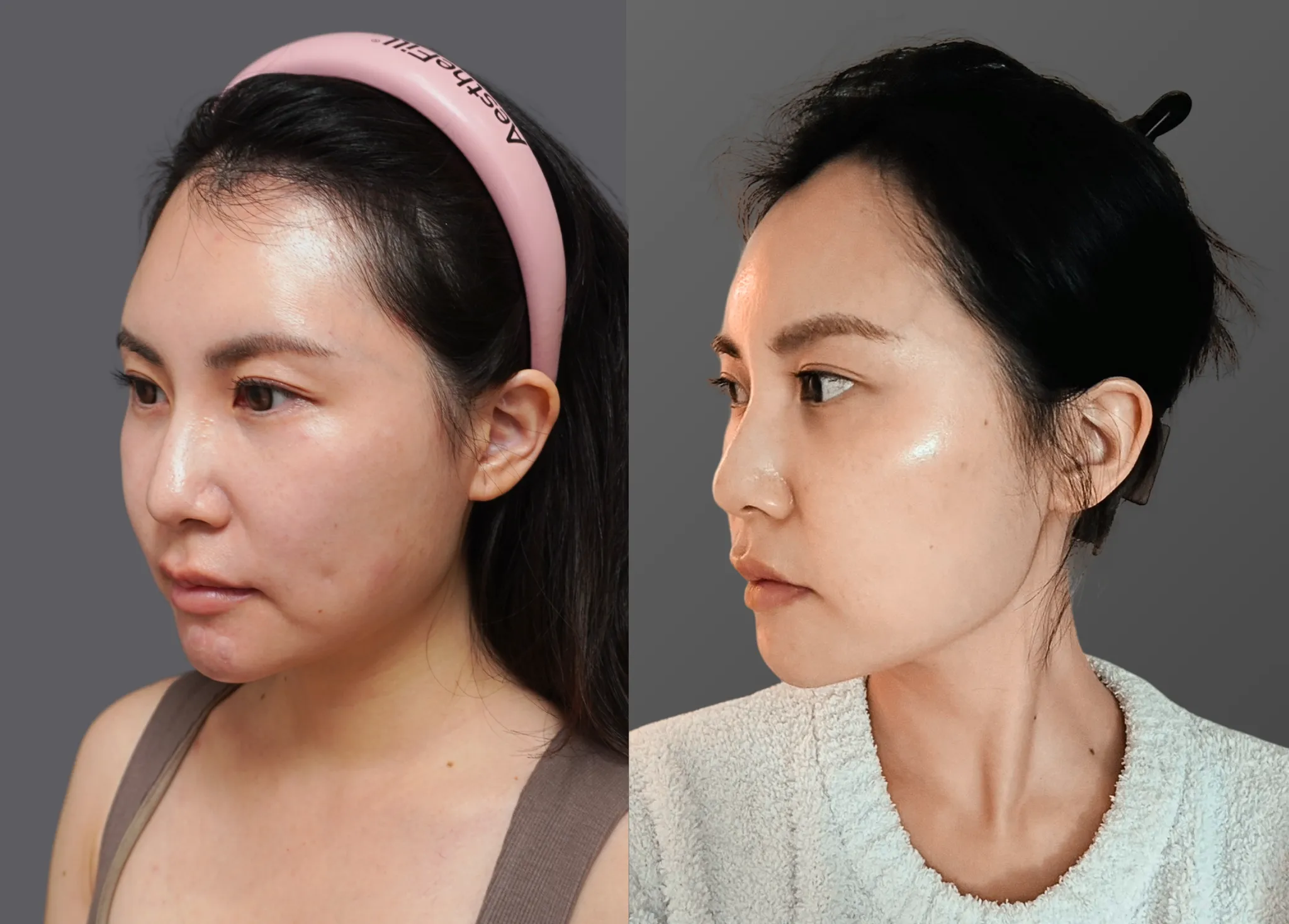 20260401 Heidi 8v無限塑顏術 Seo文 1 1