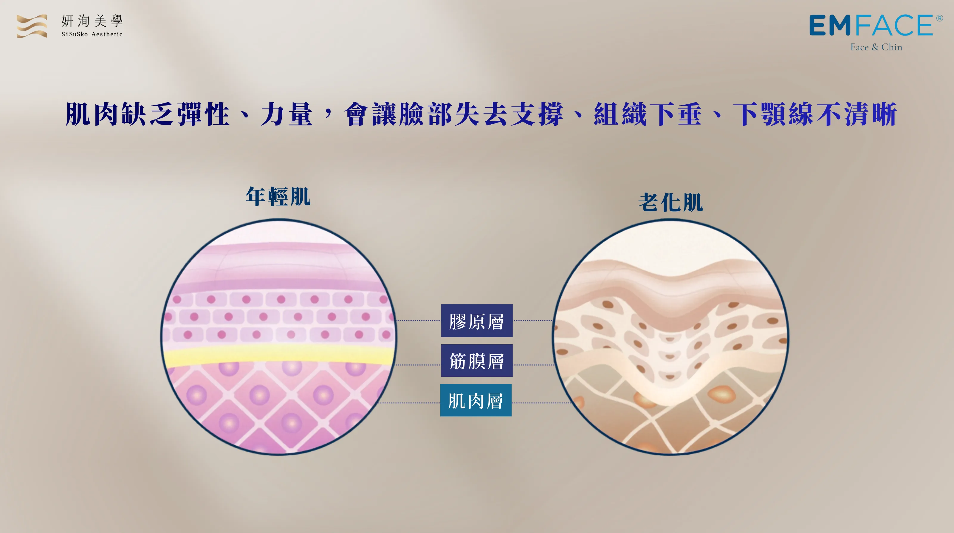 20260727 EMFACE菲斯波官網6 FIN