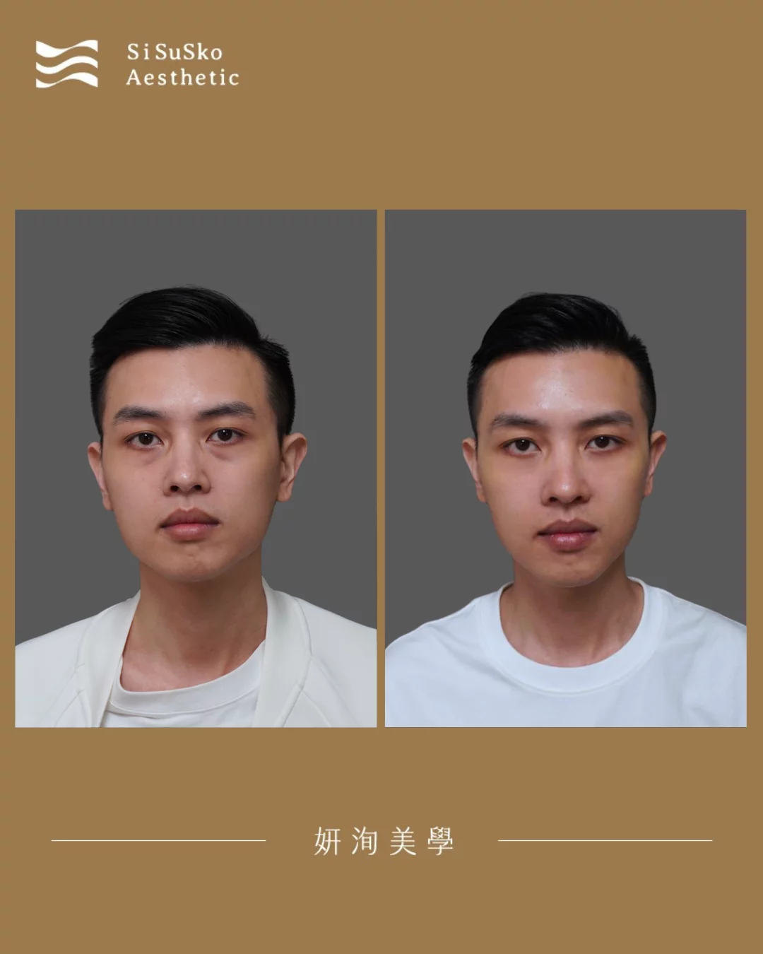 20261006 6D無痕瞳顏術 1